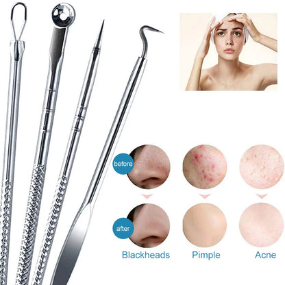 Set de 4 Aguja Removedora de Espinillas de Acne de Acero Inoxidable: Piel Radiante en Casa 🌟