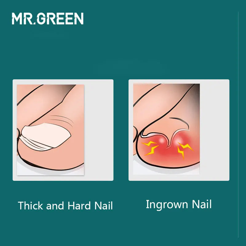 Kit de Herramientas de Manicura Profesional MR.GREEN: ¡Uñas Perfectas Garantizadas!