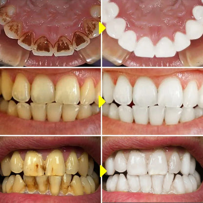 Pasta de Dientes Blanqueadora RtopR: Sonrisa Deslumbrante 🌟