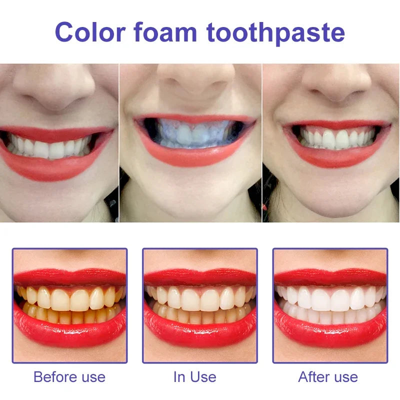 Pasta Dental Blanqueadora V34 Purple: Sonrisa Radiante en Casa 🌟