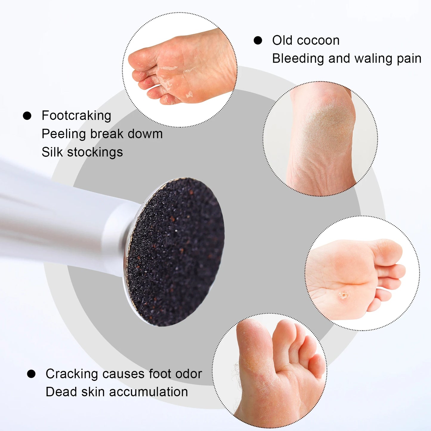 Rueda Inteligente para Pedicura de Foot Dead Skin Sandpaper: ¡Pies Suaves y Sedosos!🦶