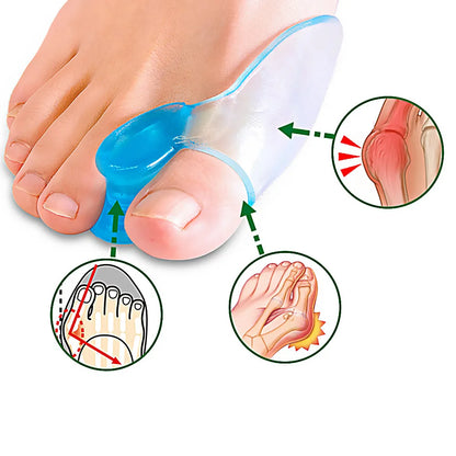 ¡Corrector de Juanetes y Hallux Valgus de Silicona Premium - Cuida tus Pies con Estilo y Confort!