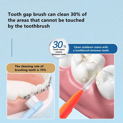 Set de 30 Cepillos Interdentales para una Sonrisa Radiante