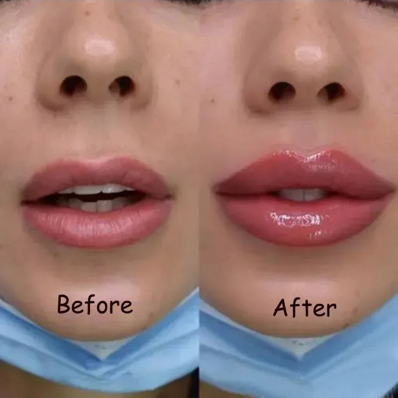 Serum Repulpante de Labios: Volumen Instantáneo y Reparación Avanzada