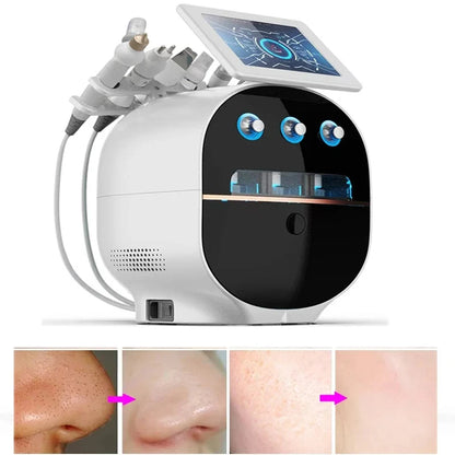 Máquina de Dermabrasión H2O2 Hydro Aaqua Peel: Piel Suave y Radiante ¡en Casa!