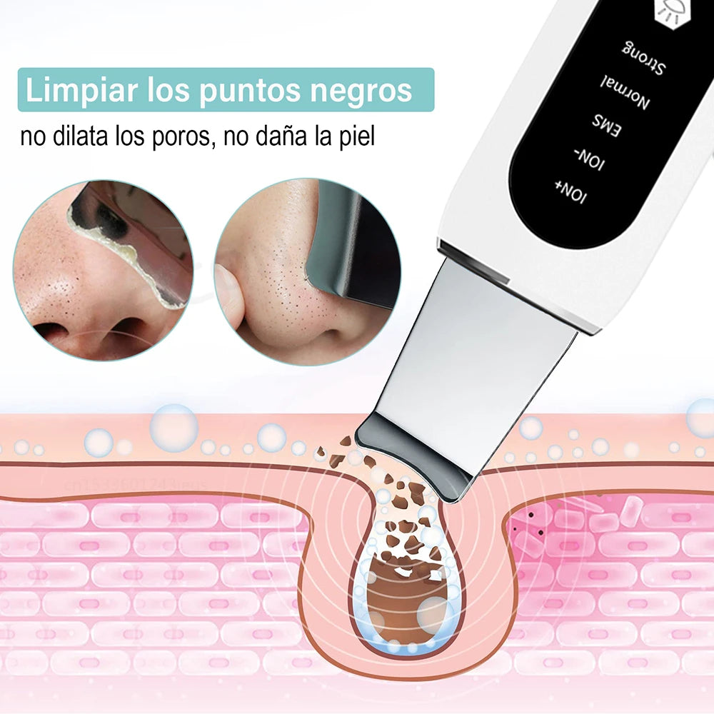 Limpiador de Poros Ultrasónico Peicon: Limpieza Profunda y Eficiente 🌟