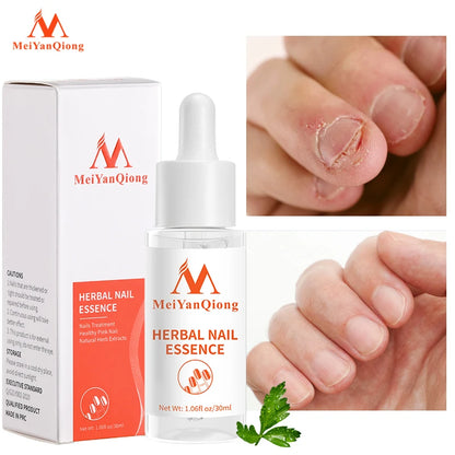 Serum de Cuidado de Uñas MeiYanQiong: Restaura, Trata y Fortalece 🌿🌟💅