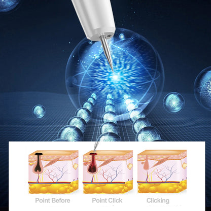 Plasma Pen de PASTSKY: Eliminador de etiquetas cutáneas y más