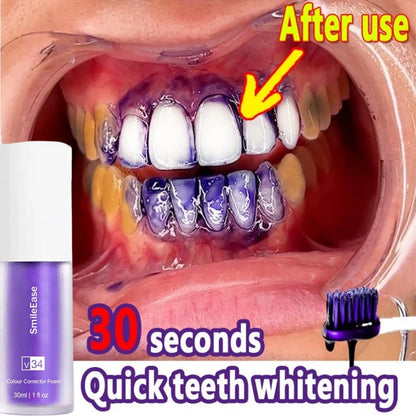 Pasta Dental Blanqueadora V34 Purple: Sonrisa Radiante en Casa 🌟