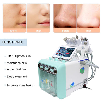 Máquina Facial Hidrodermoabrasión 6 en 1: Renueva Tu Piel al Instante 🌟